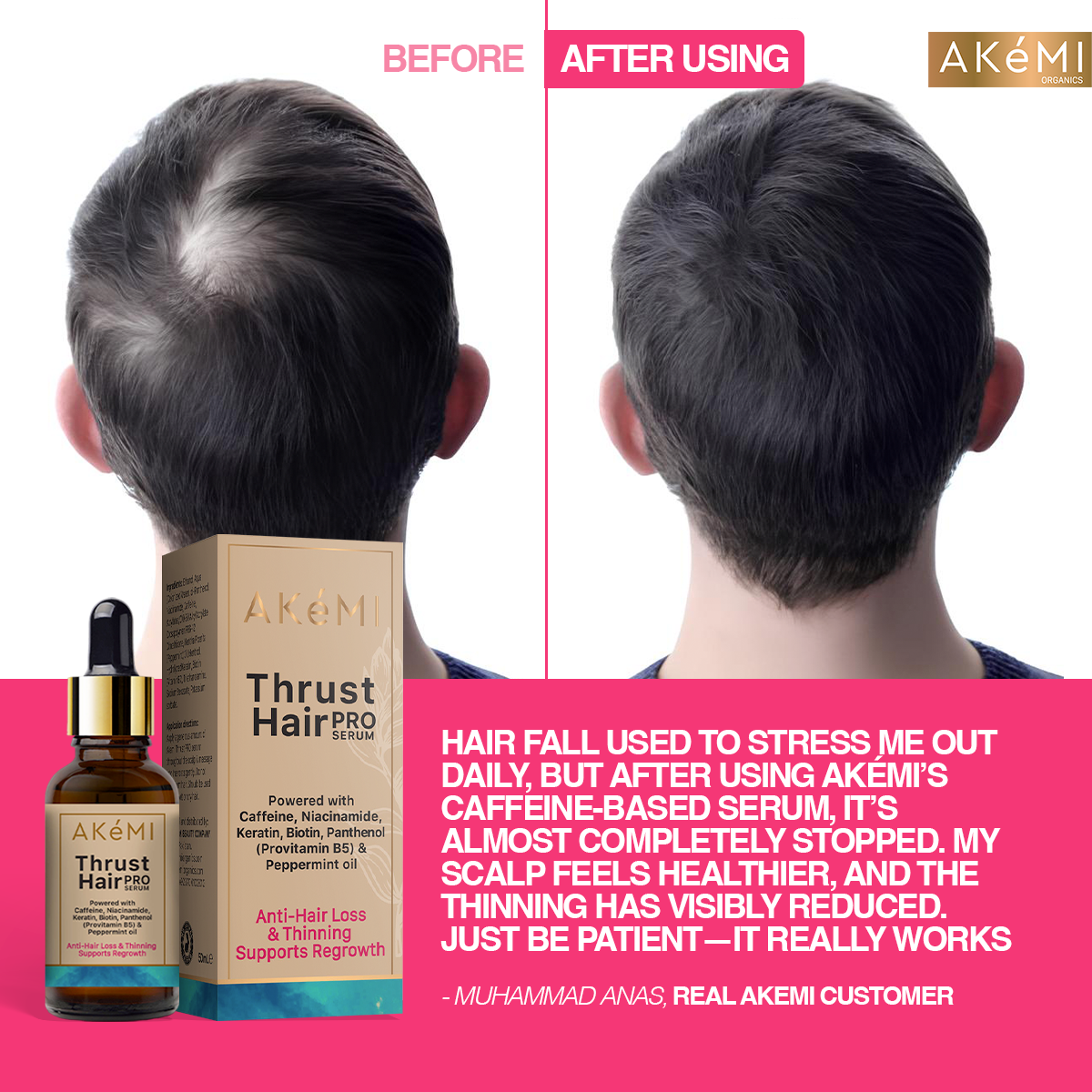Thrust Hair Pro Serum