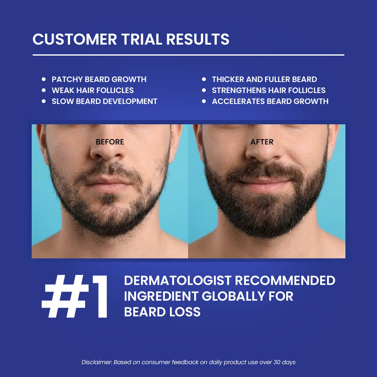 Turbo Hair Growth Serum (Minoxidil 5%) - For Beard