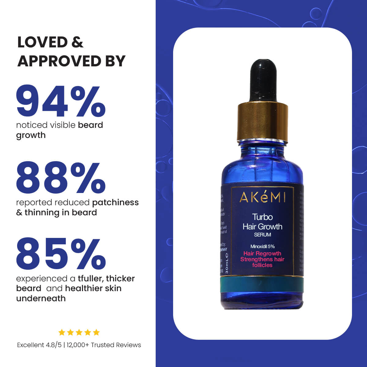 Turbo Hair Growth Serum (Minoxidil 5%) - For Beard