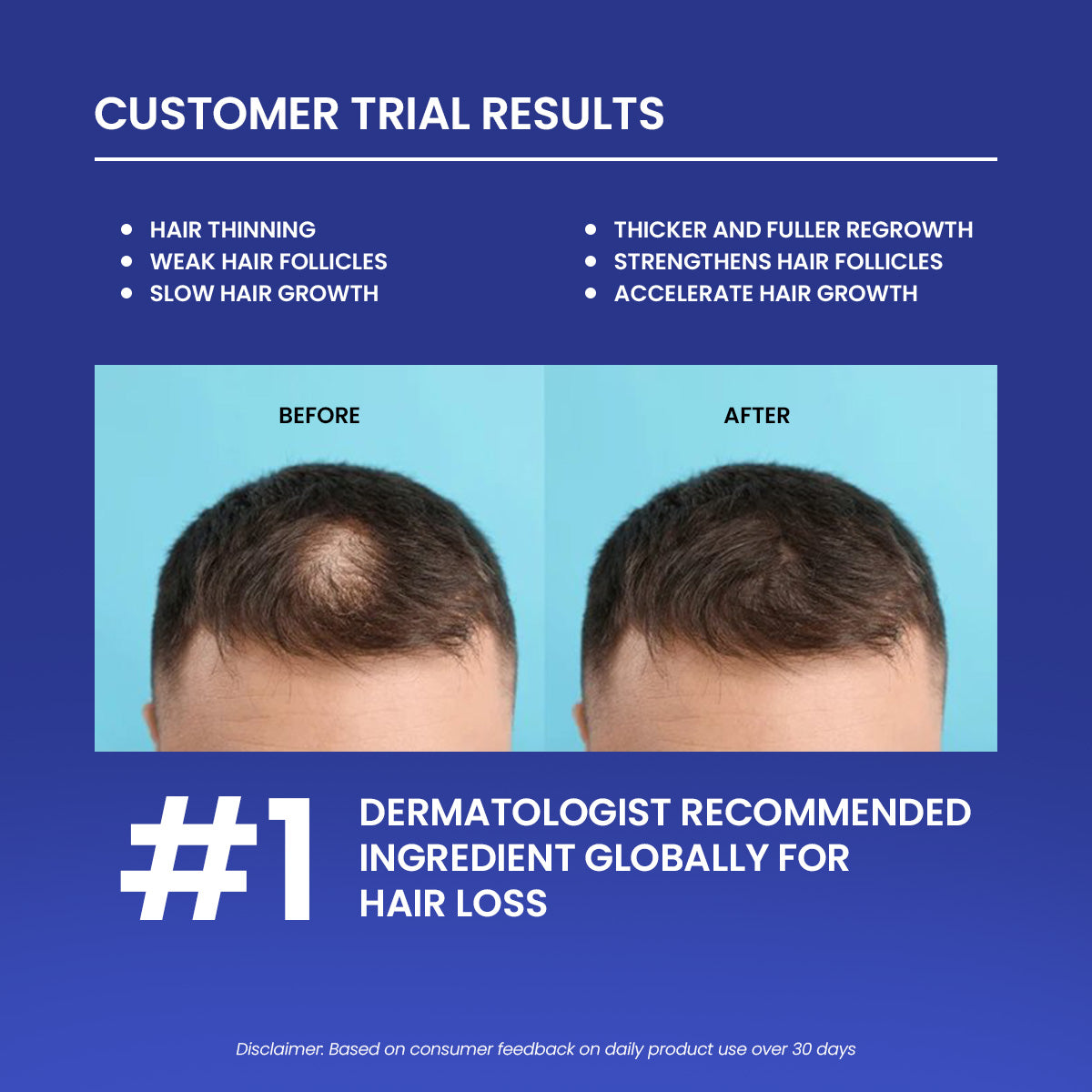 Turbo Hair Growth Serum (Minoxidil 5%)