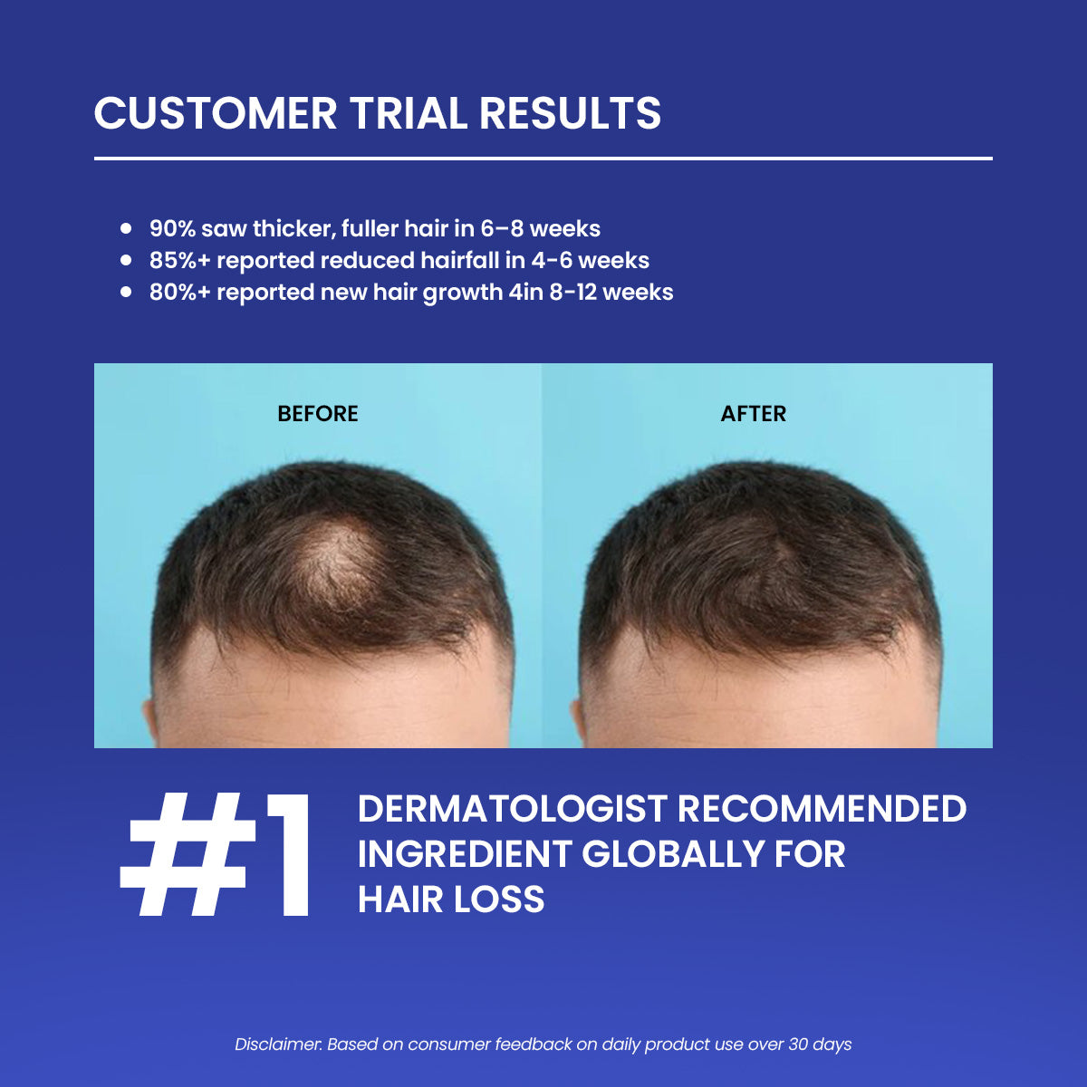 Turbo Hair Growth Serum (Minoxidil 5%)